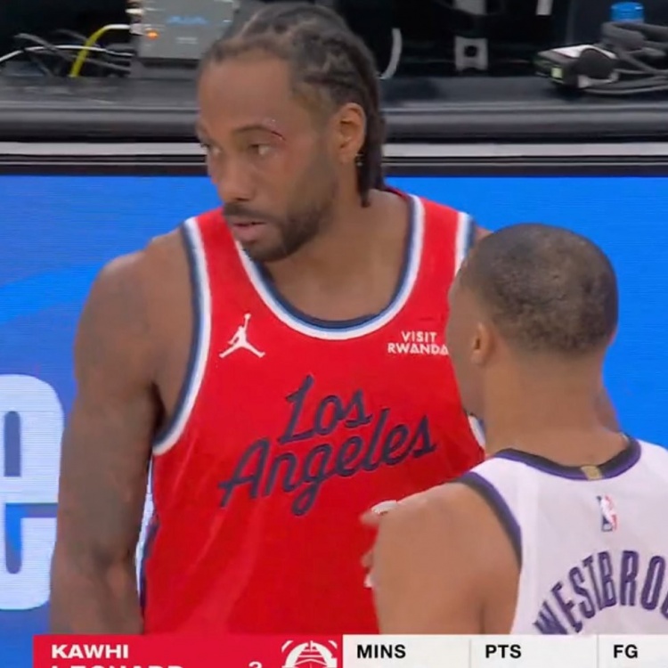 爱游戏在线-小卡眼角被打破血流不止 回更衣室治疗之后已经重回球场